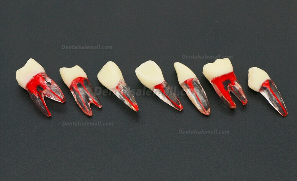 10Pcs Dental Endodontic Root Canal RCT Practice Endo Teeth Model Pulp Study